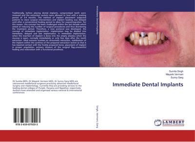 Immediate Dental Implants