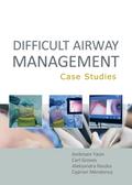 Difficult Airway Management