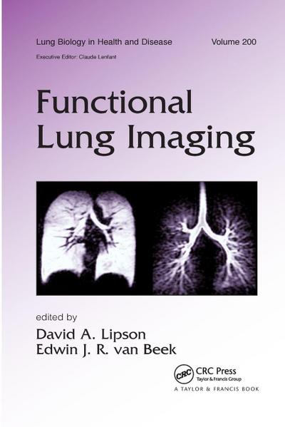 Functional Lung Imaging