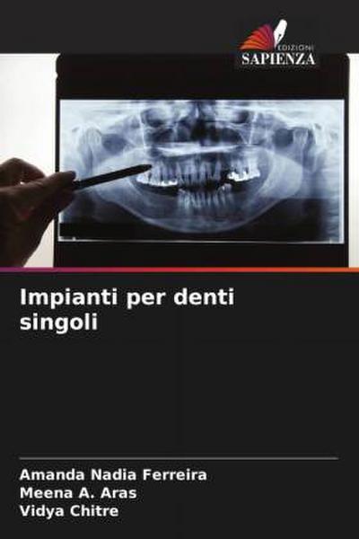 Impianti per denti singoli