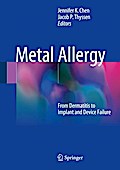 Metal Allergy