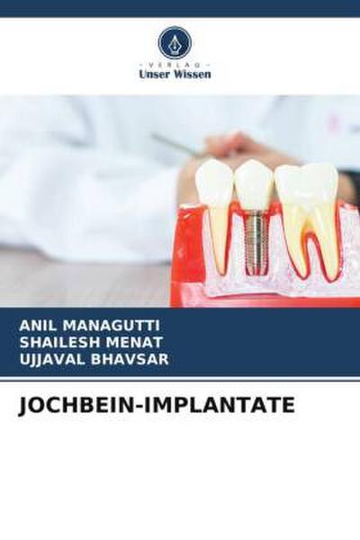 JOCHBEIN-IMPLANTATE