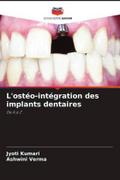 L’ostéo-intégration des implants dentaires