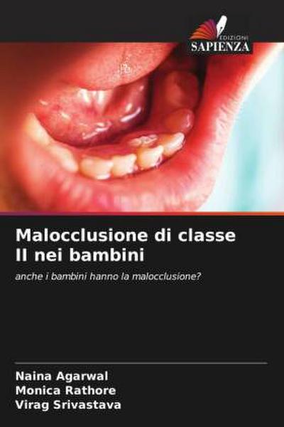 Malocclusione di classe II nei bambini