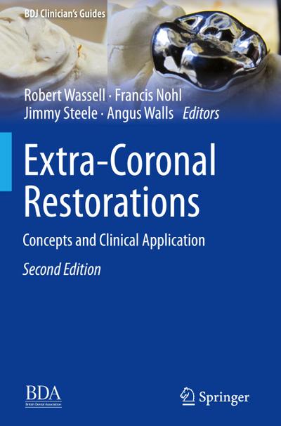 Extra-Coronal Restorations