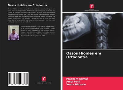 Ossos Hioides em Ortodontia