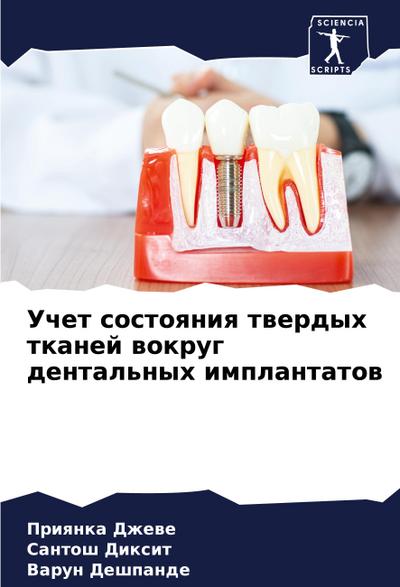 Uchet sostoqniq twerdyh tkanej wokrug dental’nyh implantatow