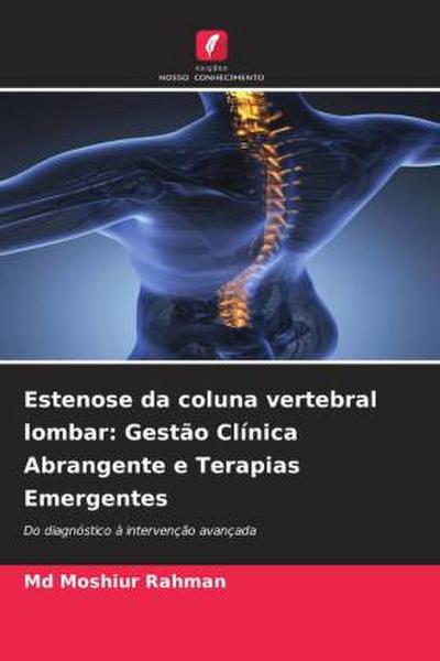 Estenose da coluna vertebral lombar: Gestão Clínica Abrangente e Terapias Emergentes
