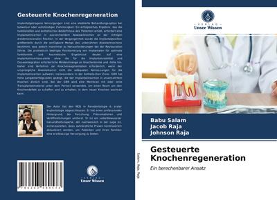 Gesteuerte Knochenregeneration