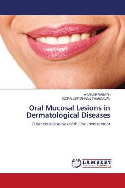 Oral Mucosal Lesions in Dermatological Diseases