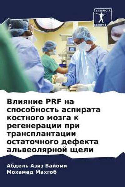 Vliqnie PRF na sposobnost’ aspirata kostnogo mozga k regeneracii pri transplantacii ostatochnogo defekta al’weolqrnoj scheli