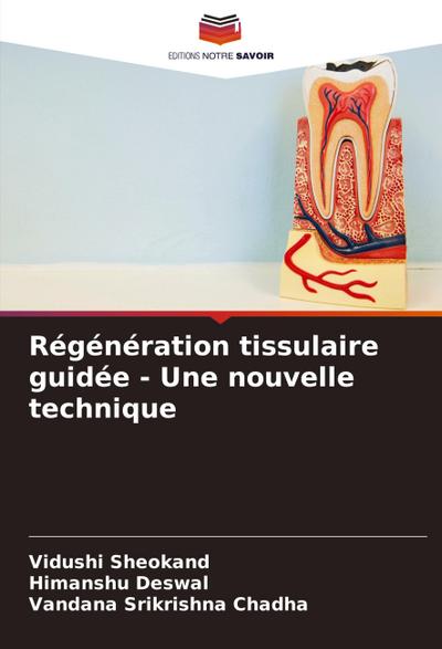 Régénération tissulaire guidée - Une nouvelle technique