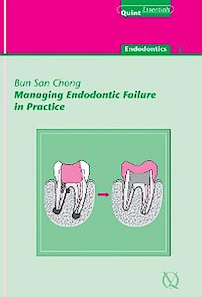 Managing Endodontic Failure in Practice