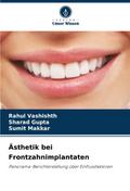 Ästhetik bei Frontzahnimplantaten