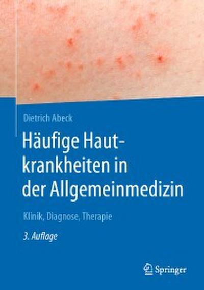 Häufige Hautkrankheiten in der Allgemeinmedizin
