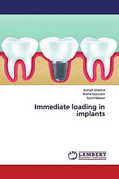 Immediate loading in implants