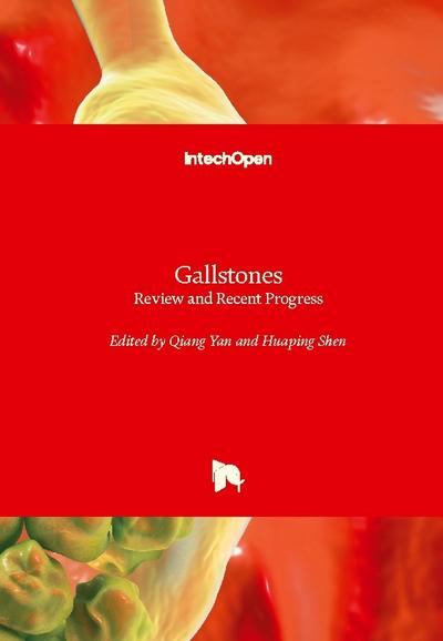 Gallstones