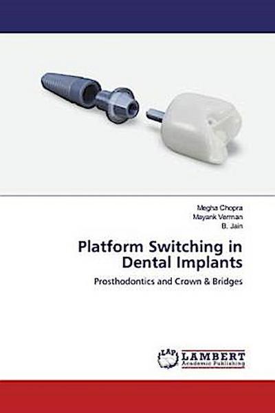 Platform Switching in Dental Implants