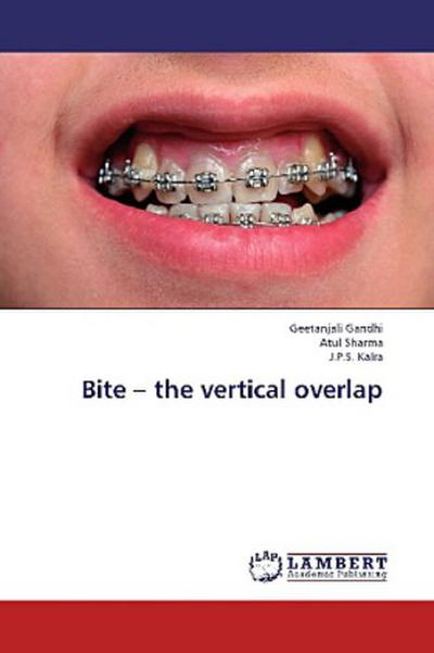 Bite - the vertical overlap