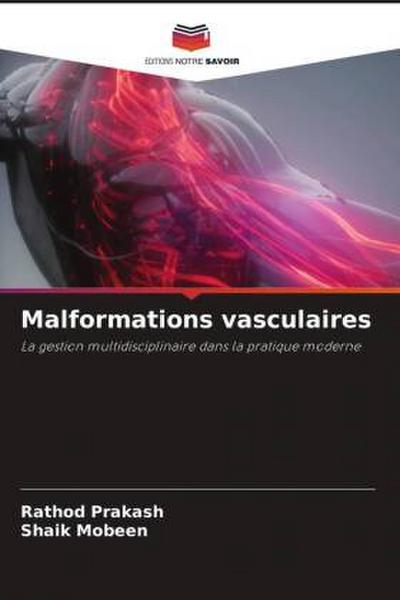 Malformations vasculaires