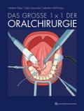 Das große 1 x 1 der Oralchirurgie