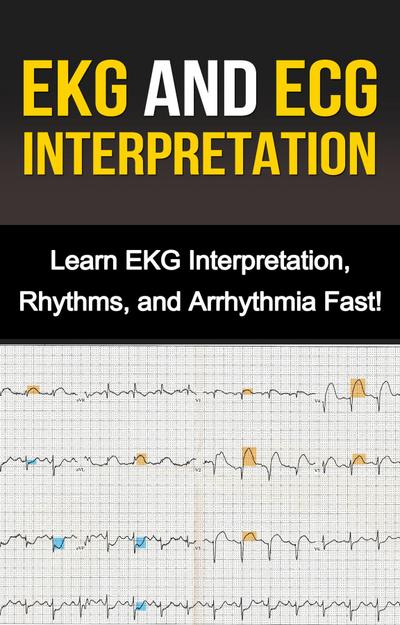 EKG and ECG Interpretation