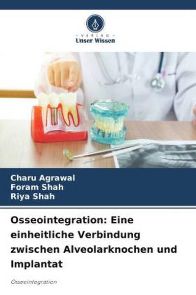 Osseointegration: Eine einheitliche Verbindung zwischen Alveolarknochen und Implantat