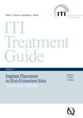Implant Placement in Post-Extraction Sites