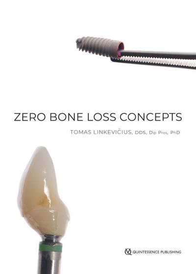 Zero Bone Loss Concepts (eBook, PDF) - Tomas Linkevičius