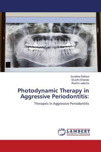 Photodynamic Therapy in Aggressive Periodontitis: