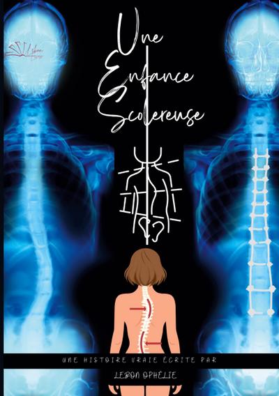 Une Enfance Scolereuse