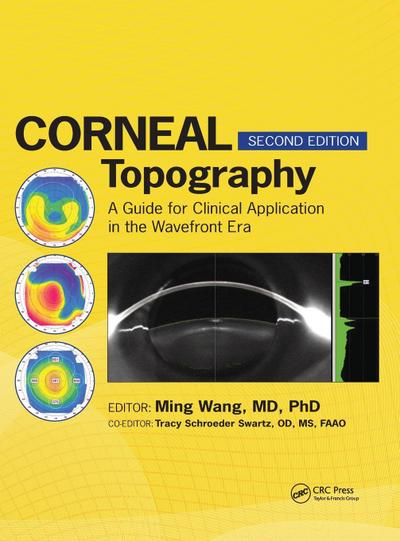Corneal Topography