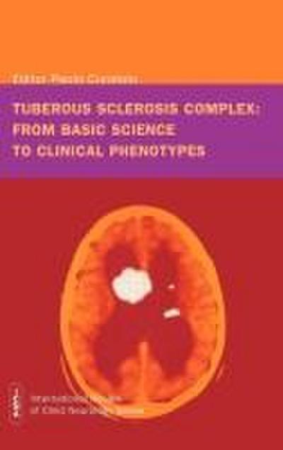 Tuberous sclerosis complex