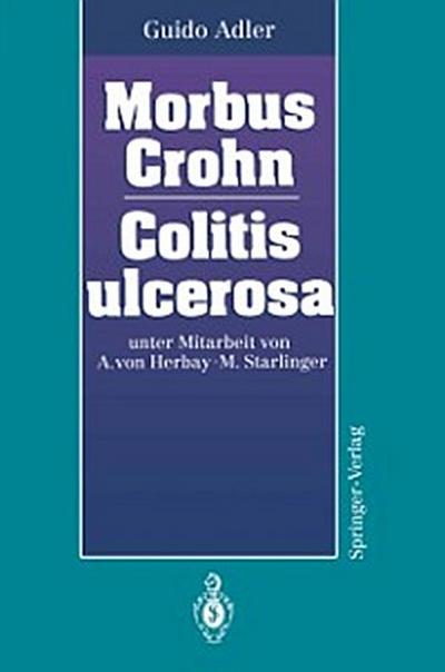 Morbus Crohn Colitis ulcerosa