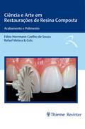 Ciência e Arte em Restaurações de Resina Composta