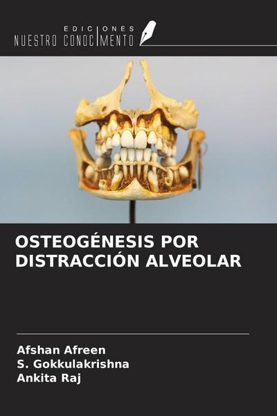 OSTEOGÉNESIS POR DISTRACCIÓN ALVEOLAR