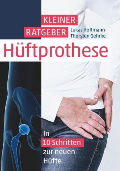 Kleiner Ratgeber Hüftprothese