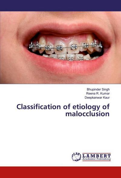 Classification of etiology of malocclusion