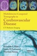 Multidetector Computed Tomography in Cerebrovascul