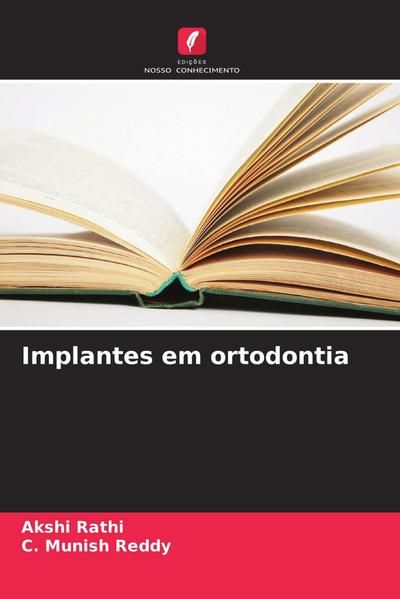 Implantes em ortodontia