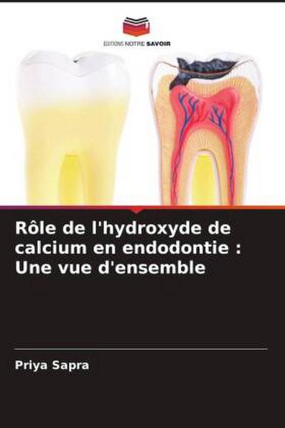 Rôle de l’hydroxyde de calcium en endodontie : Une vue d’ensemble