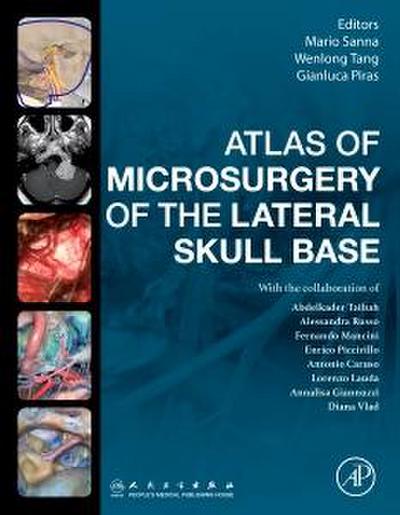 Atlas of Microsurgery of the Lateral Skull Base