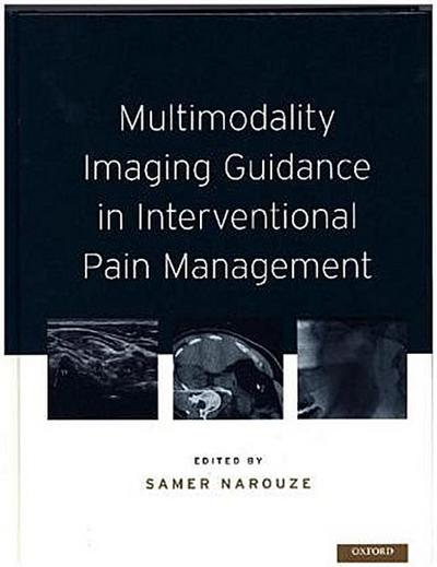 Multimodality Imaging Guidance in Interventional Pain Management