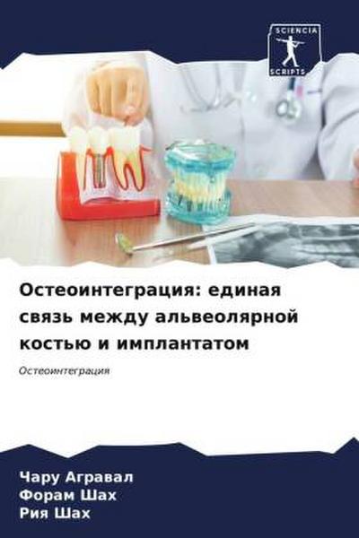 Osteointegraciq: edinaq swqz’ mezhdu al’weolqrnoj kost’ü i implantatom