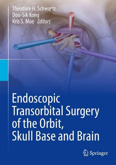 Endoscopic Transorbital Surgery of the Orbit, Skull Base and Brain