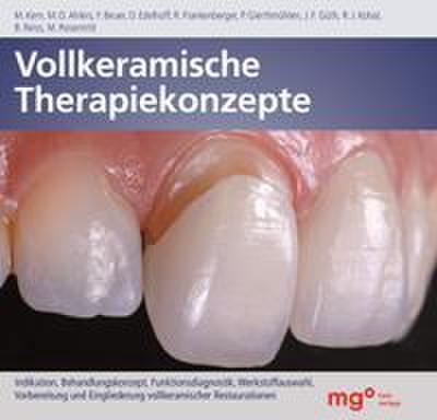 Vollkeramische Therapiekonzepte