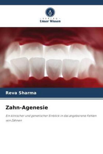 Zahn-Agenesie