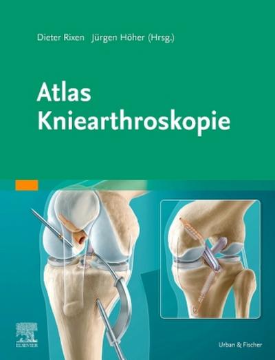 Atlas Kniearthroskopie