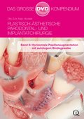 Plastisch-Ästhetische Parodontal- und Implantatchirurgie