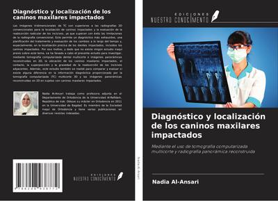 Diagnóstico y localización de los caninos maxilares impactados